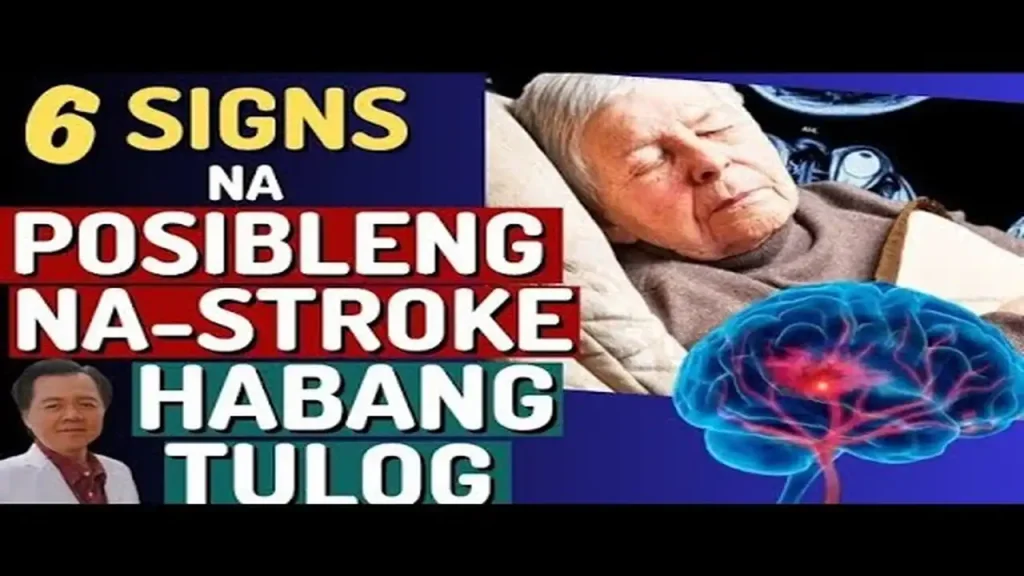 6 Babala ng Stroke Habang Natutulog: Huwag Balewalain ang Sintomas