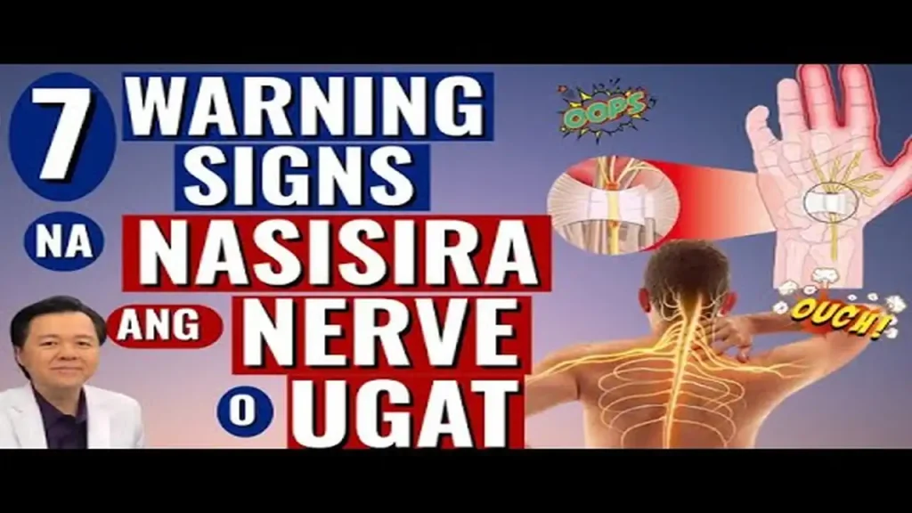 Senyales ng Nasisirang Nerve at Mabisang Lunas sa Pangangimay