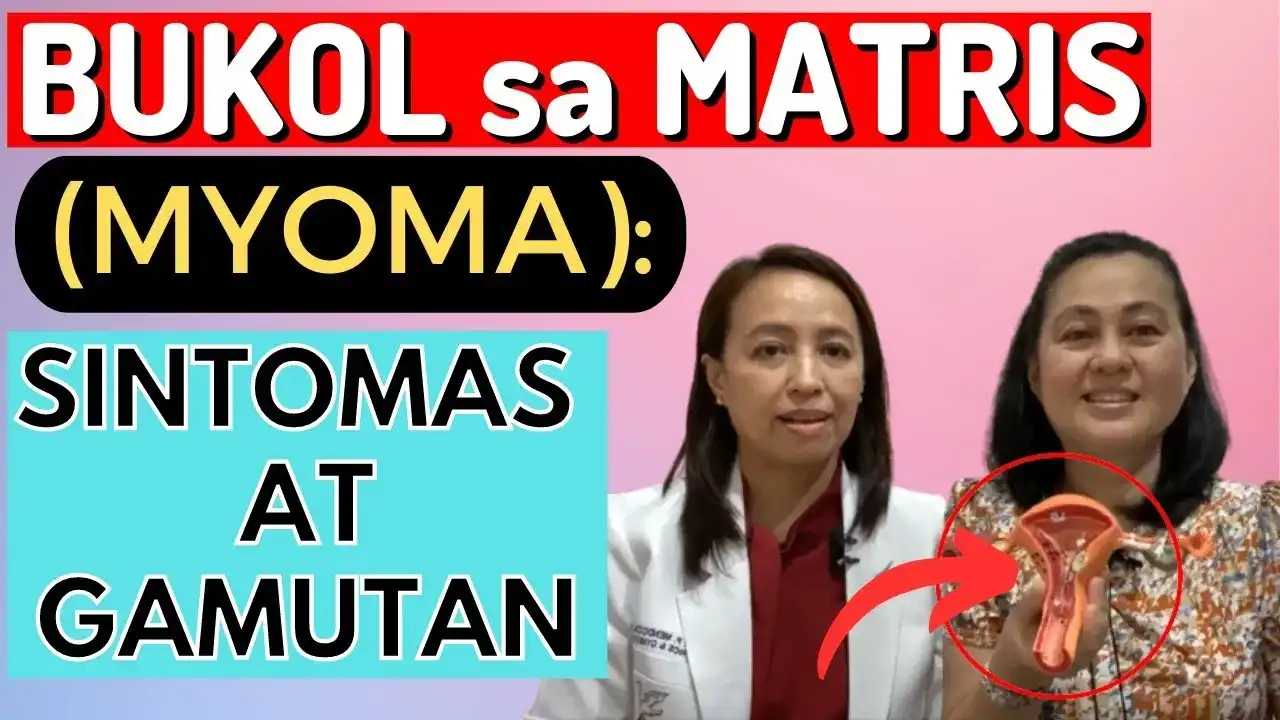 Kalusugan ng Kababaihan: Gabay at Lunas sa Myoma sa Matris
