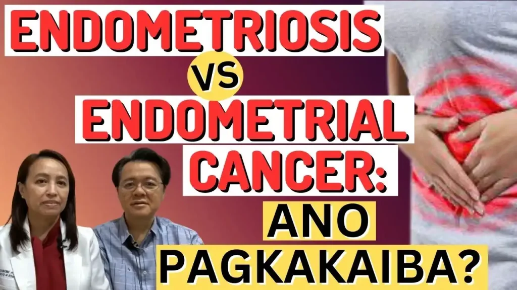 Kalusugan ng Kababaihan: Pagkakaiba ng Endometriosis at Cancer