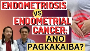 Kalusugan ng Kababaihan: Pagkakaiba ng Endometriosis at Cancer