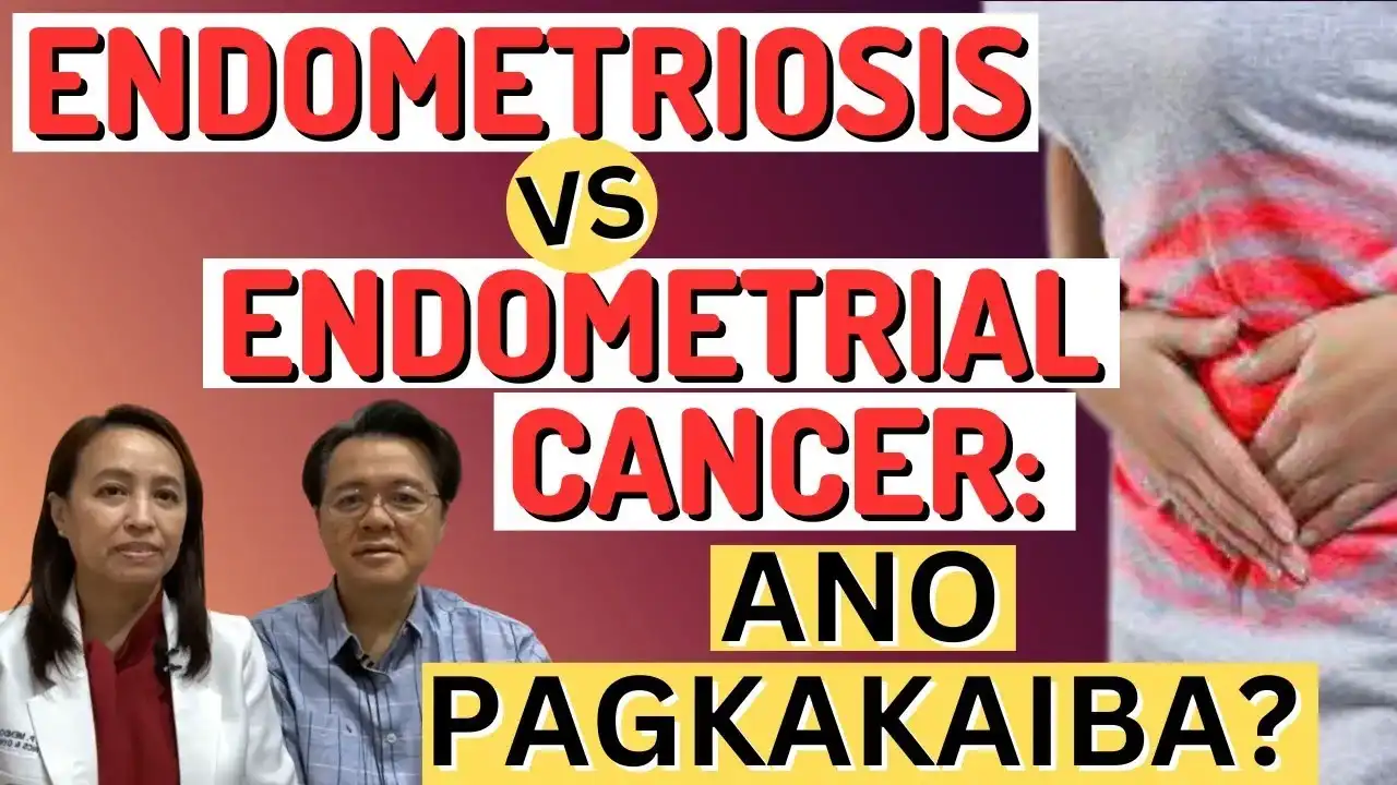 Kalusugan ng Kababaihan: Pagkakaiba ng Endometriosis at Cancer