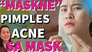 Doc Liza Tips: Mabisang Lunas sa Maskne at Pimples sa Mukha