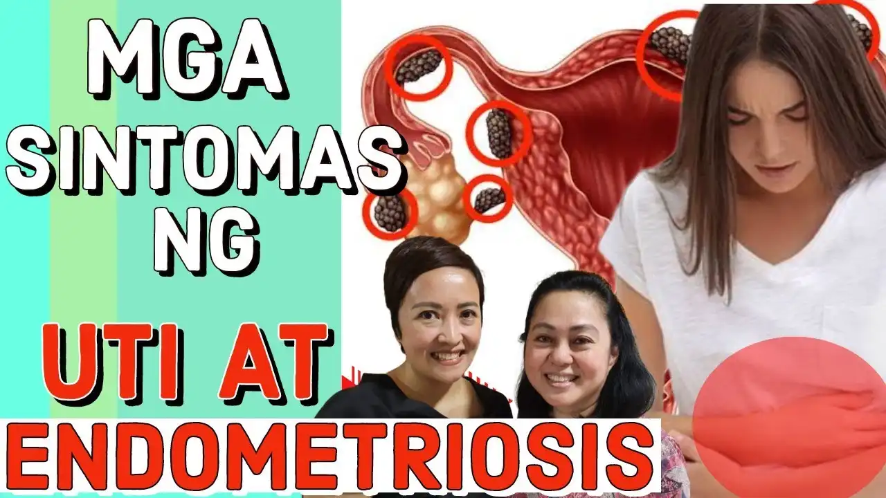 Kalusugan ng Kababaihan: Pagkakaiba ng UTI sa Endometriosis