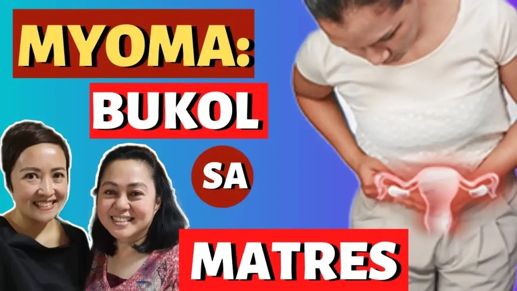 Kalusugan ng Kababaihan: Gabay at Lunas sa Myoma sa Matres