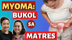 Kalusugan ng Kababaihan: Gabay at Lunas sa Myoma sa Matres