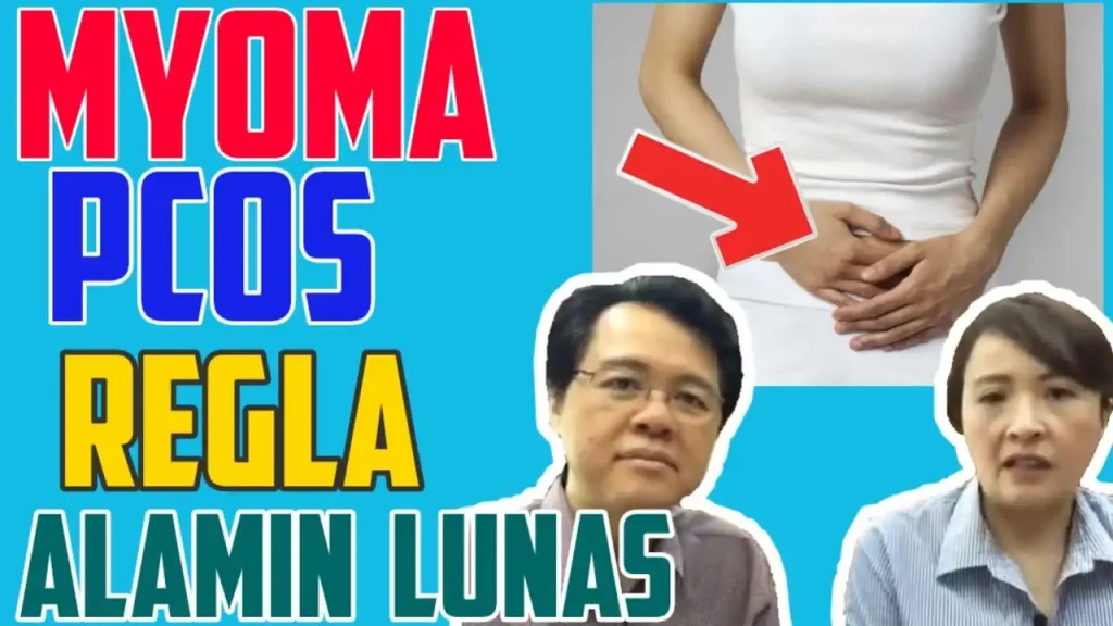 Doc Liza Tips: Lunas sa Myoma, PCOS, at Iregular na Regla