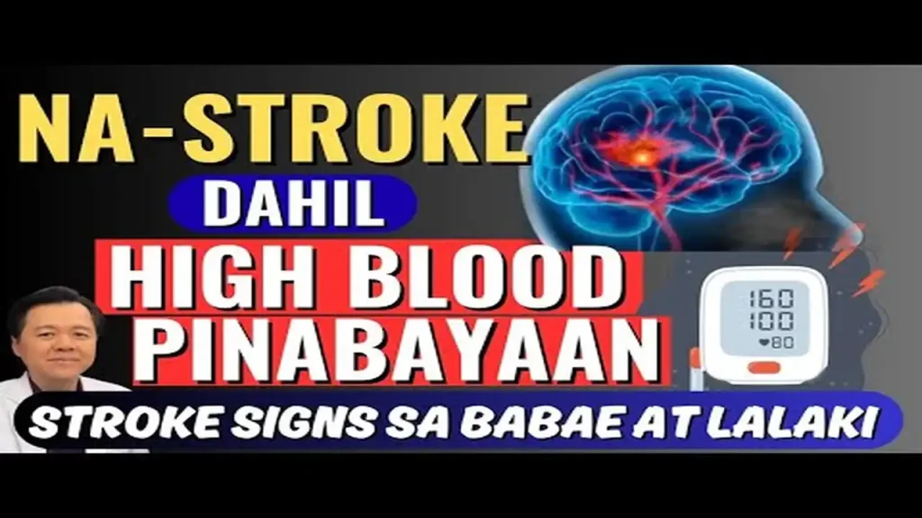 Pinabayaang Altapresyon: Paano Ito Nagiging Stroke at Paralisis