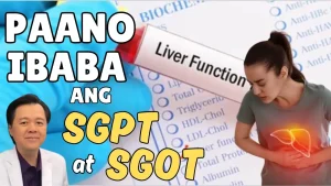 Mataas na SGPT at SGOT: Mabisang Paraan para Protektahan ang Atay