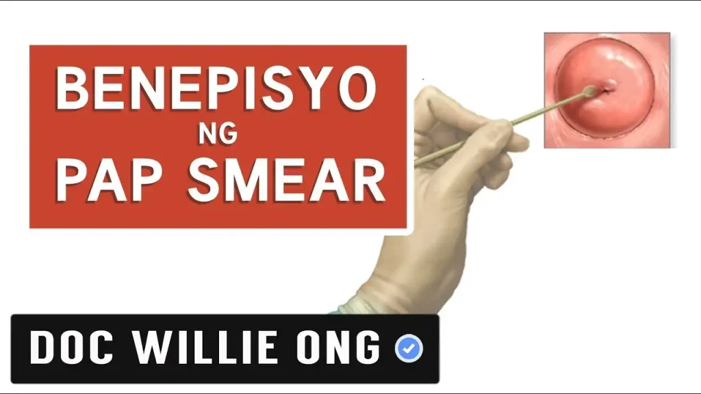 Kalusugan ng Kababaihan: Gabay sa Komportableng Pap Smear