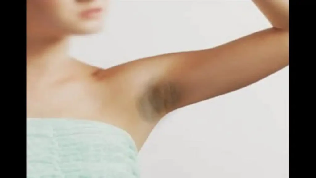 Doc Liza Tips: Lunas sa Maitim na Kili-Kili para sa mga Babae