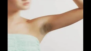 Doc Liza Tips: Lunas sa Maitim na Kili-Kili para sa mga Babae