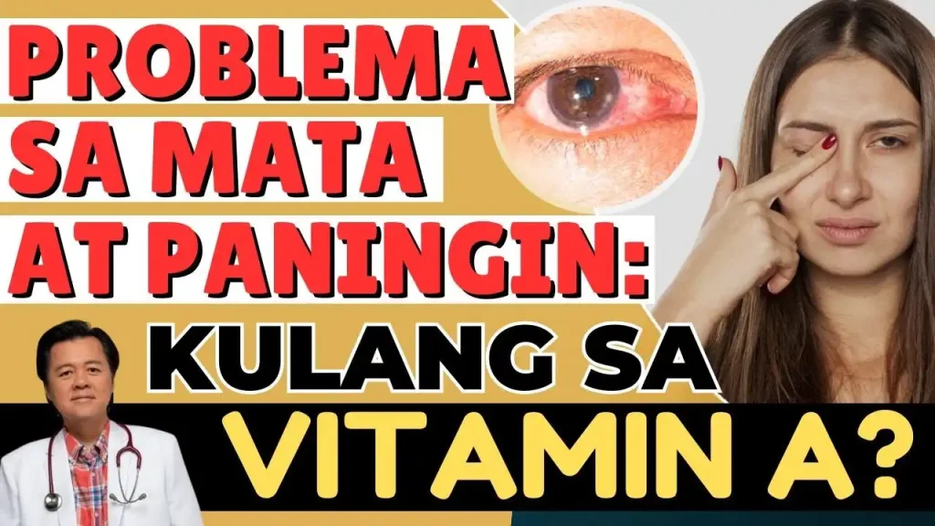 Malabong Paningin Ba? Senyales Ito ng Kakulangan sa Vitamin A