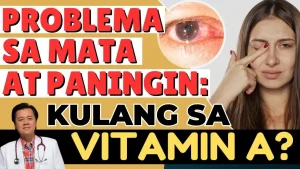 Malabong Paningin Ba? Senyales Ito ng Kakulangan sa Vitamin A