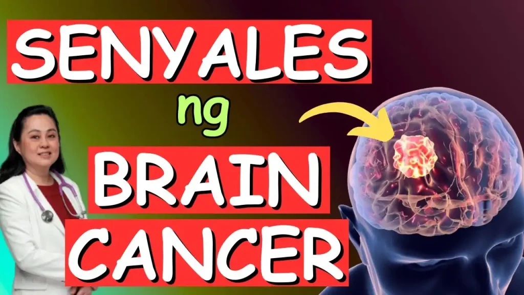 Mga Babalang Senyales ng Brain Cancer na Dapat Bantayan