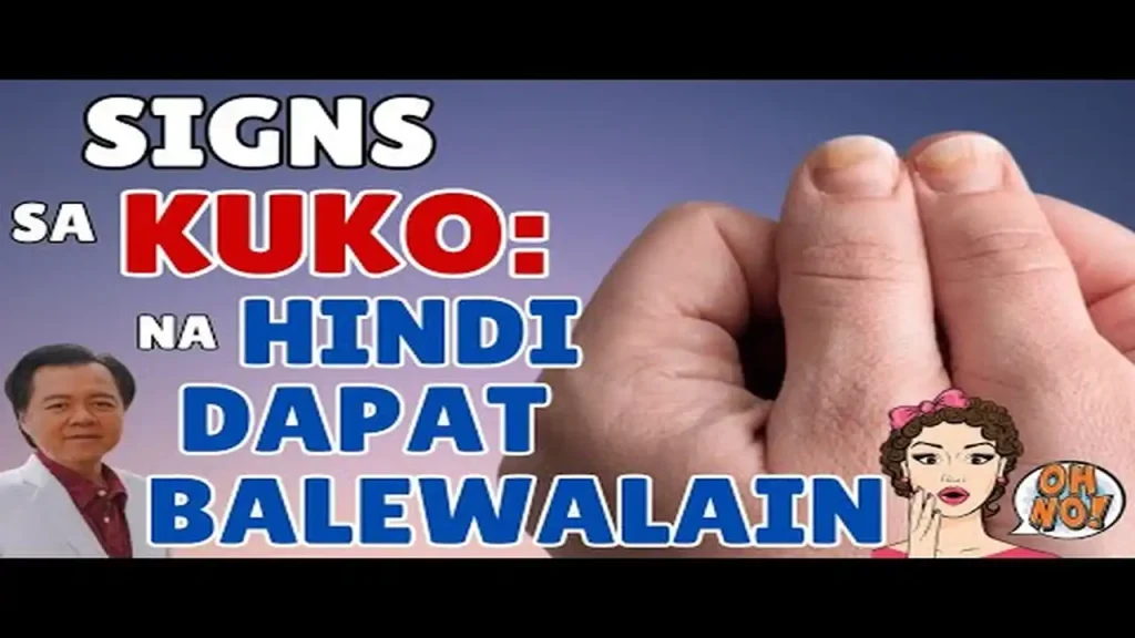 Babala sa Kuko: Mga Sintomas na Hindi Dapat Balewalain