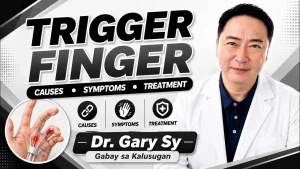 Mabisang Lunas at Natural na Solusyon sa Trigger Finger