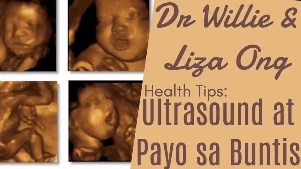 Kalusugan ng Kababaihan: Gabay sa Ultrasound at Pagbubuntis