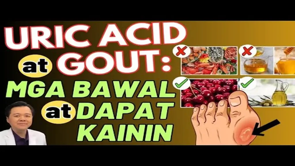 Gout at Uric Acid: Tamang Diet at Pagkaing Dapat Iwasan