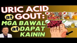Gout at Uric Acid: Tamang Diet at Pagkaing Dapat Iwasan