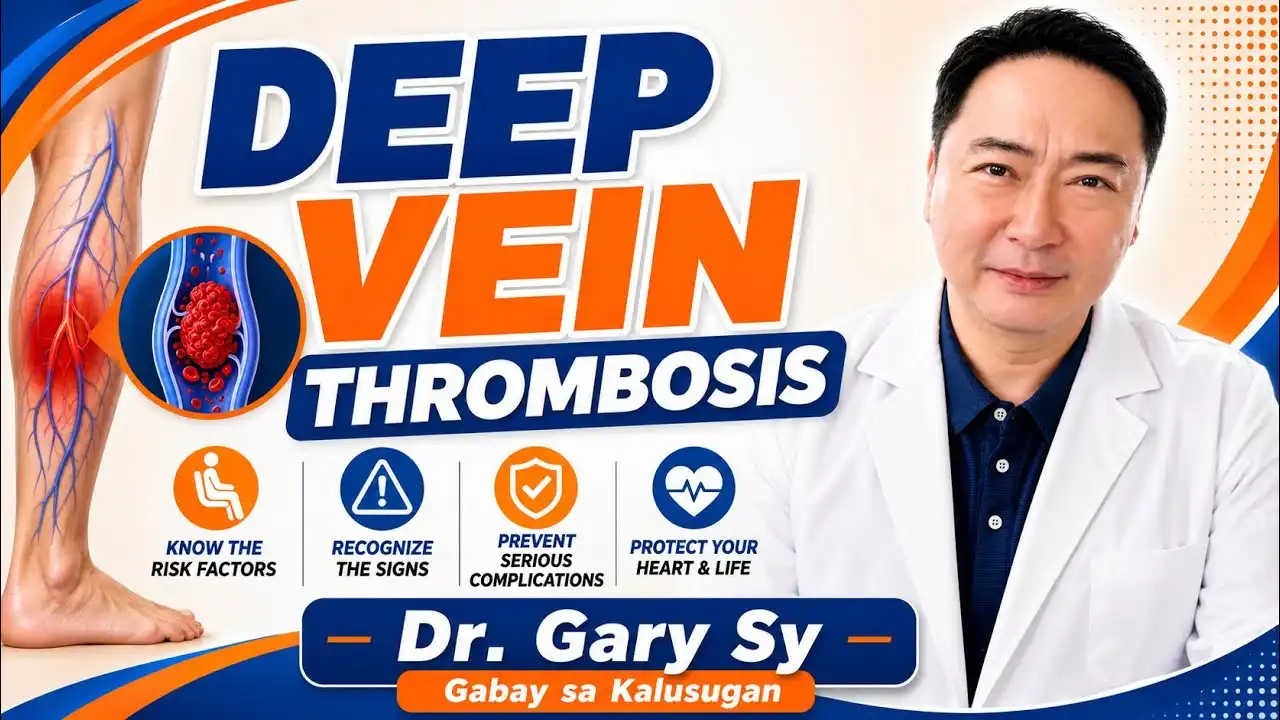 Mapanganib na Blood Clot sa Paa: Sintomas at Lunas sa DVT