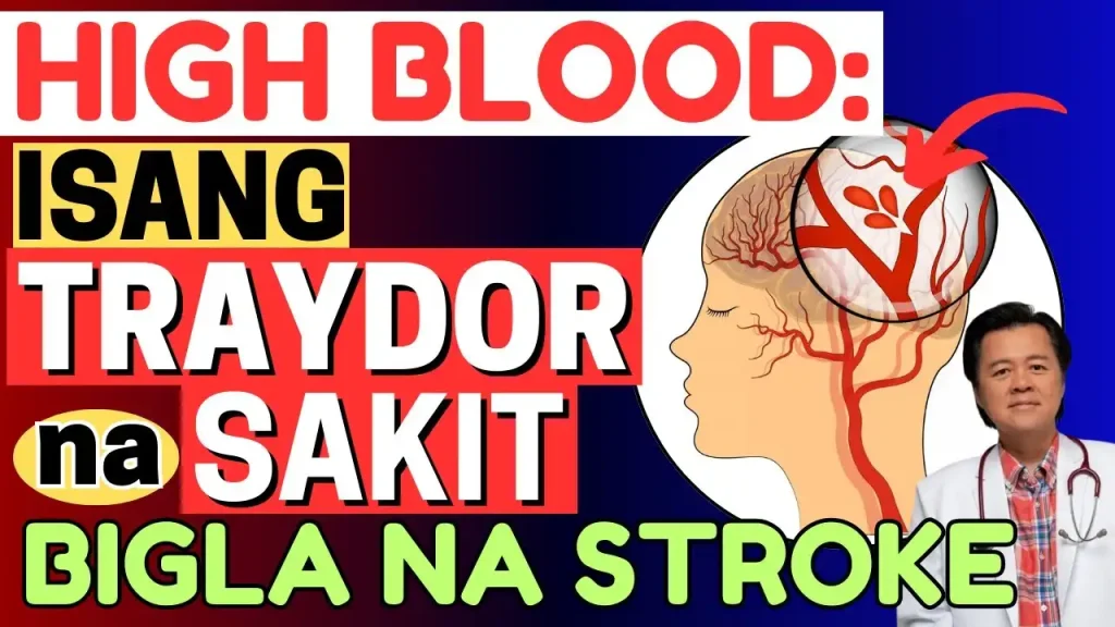 Banta ng High Blood: Sintomas at Lunas Laban sa Biglaang Stroke